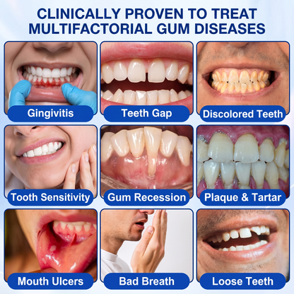 🇬🇧Pureluxo® 🦷GumRevive periodontal repair gel🌿