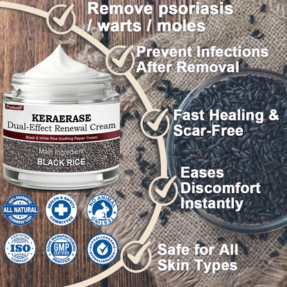 Pureluxo® KERAERASE Dual-Effect Renewal Cream — MHRA-certified treatment for abnormal skin growths and damage (suitable for warts, seborrhoeic keratosis, skin tags, keratin build-up, pigmentation, age spots, hyperplasia, and more).