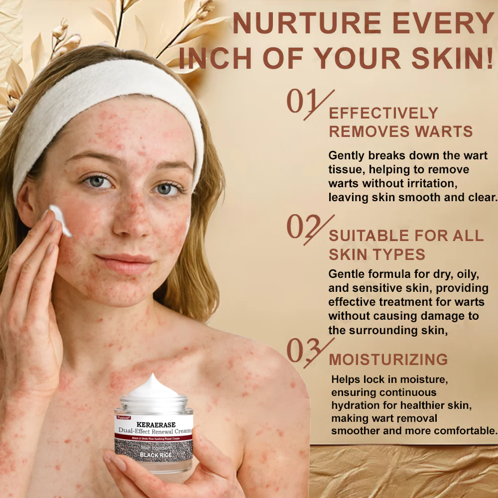 Pureluxo® KERAERASE Dual-Effect Renewal Cream — MHRA-certified treatment for abnormal skin growths and damage (suitable for warts, seborrhoeic keratosis, skin tags, keratin build-up, pigmentation, age spots, hyperplasia, and more).