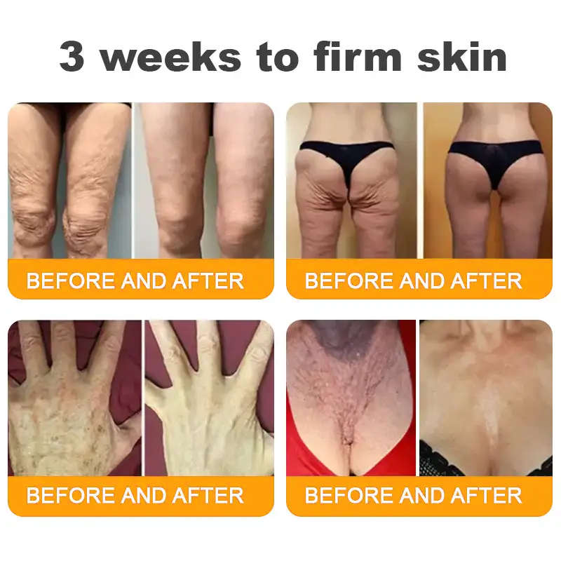 Made and Shipped from UK ✨ Pureluxo® Bee Venom Skin Restoration Cream ⏰ LAST DAY 80% OFF