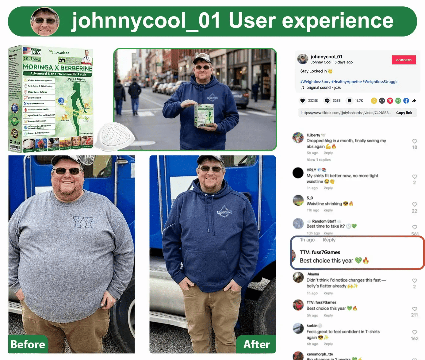 𝑶𝒇𝒇𝒊𝒄𝒊𝒂𝒍 𝒔𝒕𝒐𝒓𝒆 | 🩹𝙋𝙪𝙧𝙚𝙡𝙪𝙭𝙤® 𝐌𝐨𝐫𝐢𝐧𝒈𝗮 𝑩𝒆𝒓𝒃𝒆𝐫𝐢𝐧𝐞𝐱 𝐍𝗔𝒟+ 10-𝑖n-1 𝐍a𝒏𝒐 𝐌𝐢𝐜𝐫𝑜𝑛𝑒𝑒𝗱𝗹𝗲 𝐏𝐚𝒕𝒄𝒉🇬🇧(𝐉𝐮𝐬𝐭 𝐨𝐧𝐜𝐞 𝐚 𝐝𝐚𝐲, 𝐯𝐢𝐬𝐢𝐛𝐥𝐞 𝐜𝐡𝐚𝐧𝐠𝐞𝐬 𝐢𝐧 𝟕 𝑫𝐚𝐲𝐬） ✅ 𝐅𝐨𝐫 𝐎𝐛𝐞𝐬𝐢𝐭𝐲, 𝙇𝙊𝙊𝙎𝗘 𝗦𝗞𝗜𝗡,𝐝𝐢𝐚𝐛𝐞𝐭𝙚𝙨, 𝐬𝐥𝐞𝐞𝐏 𝐚𝐩𝐧𝐞𝐚, 𝐣𝐨𝐢𝐧𝐭 𝐢𝐬𝐬𝐮𝙚𝙨, 𝐚𝐧𝐝 𝐦𝐨𝐫𝐞 🎄