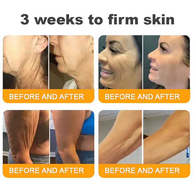 Made and Shipped from UK ✨ Pureluxo® Bee Venom Skin Restoration Cream ⏰ LAST DAY 80% OFF