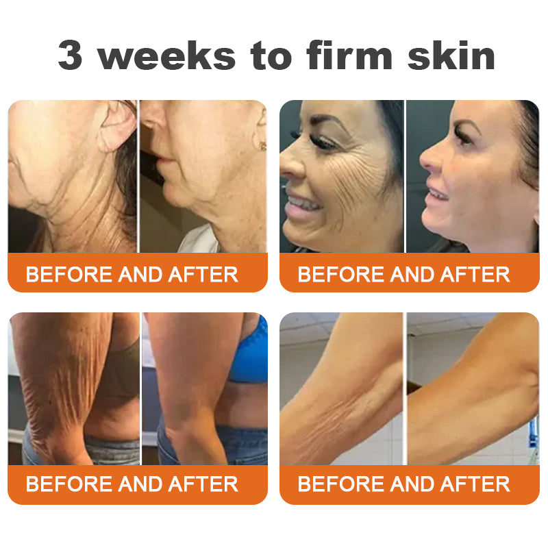 Made and Shipped from UK✨Pureluxo® Botox Bee Venom Firming Serum Stick(🔥LAST DAY 70% OFF) 🛒