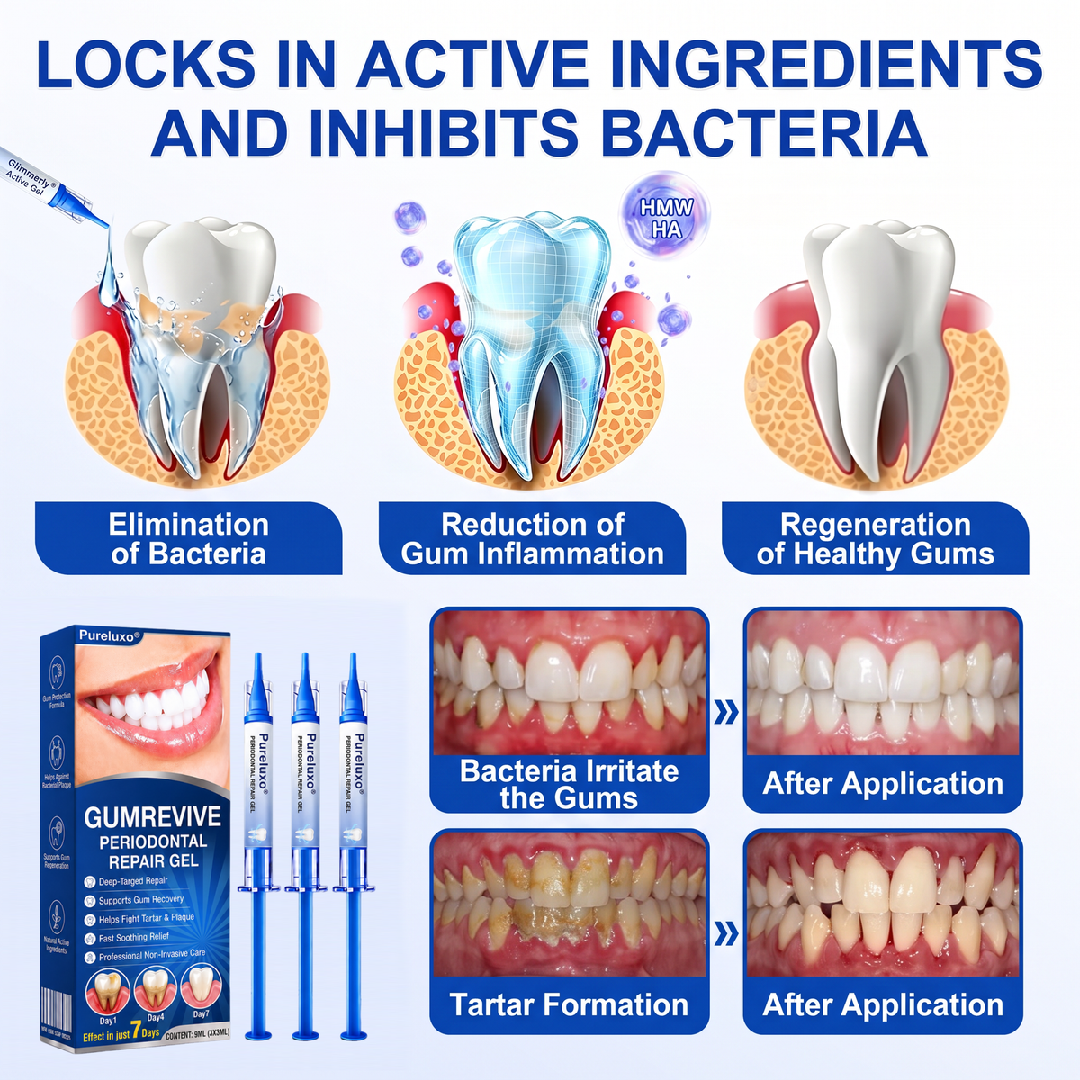 🇬🇧Pureluxo® 🦷GumRevive periodontal repair gel🌿