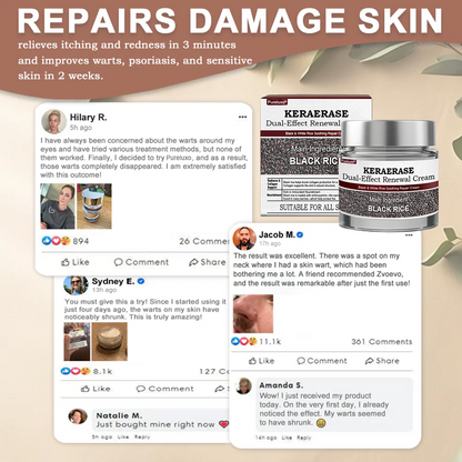 Pureluxo® KERAERASE Dual-Effect Renewal Cream — MHRA-certified treatment for abnormal skin growths and damage (suitable for warts, seborrhoeic keratosis, skin tags, keratin build-up, pigmentation, age spots, hyperplasia, and more).