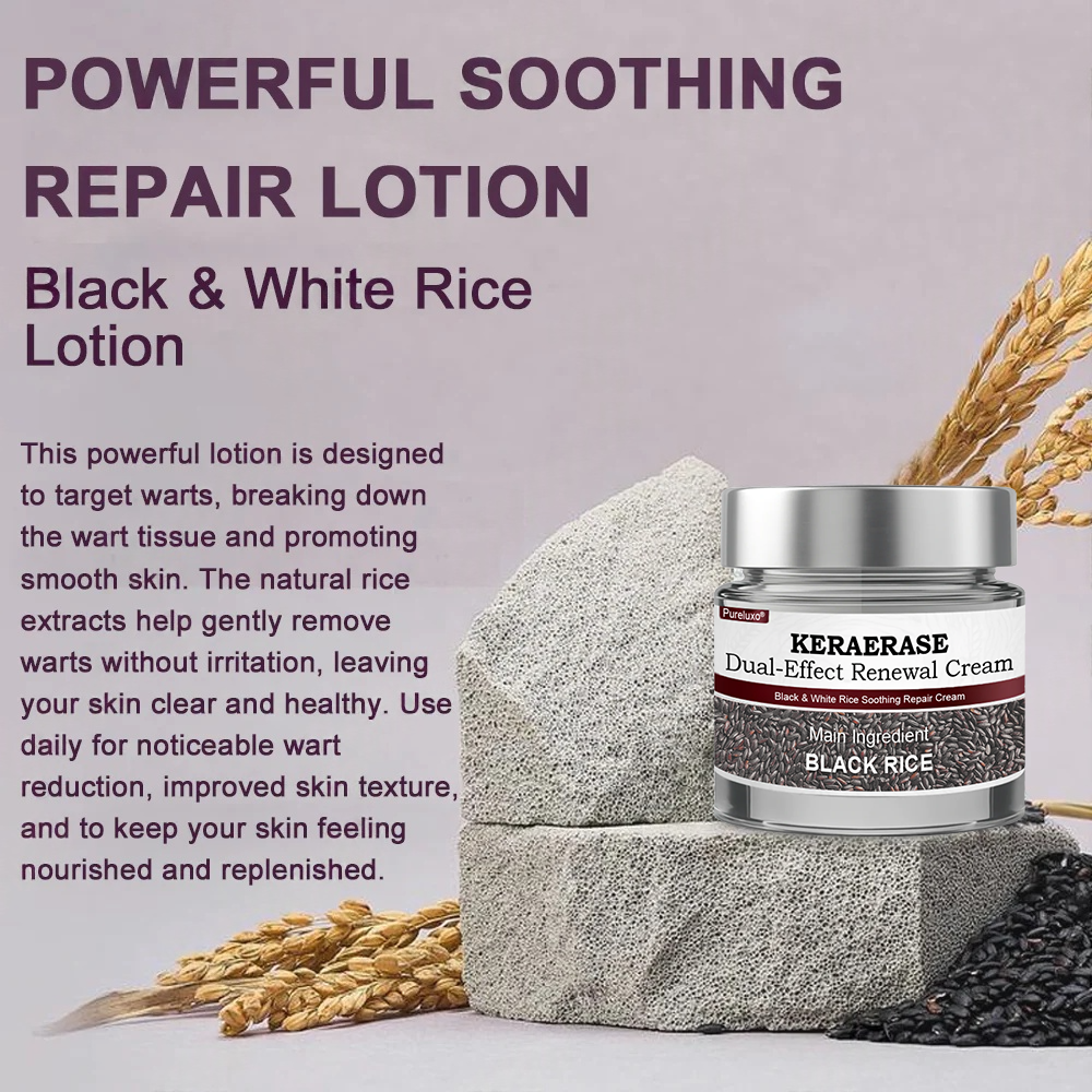 Pureluxo® KERAERASE Dual-Effect Renewal Cream — MHRA-certified treatment for abnormal skin growths and damage (suitable for warts, seborrhoeic keratosis, skin tags, keratin build-up, pigmentation, age spots, hyperplasia, and more).